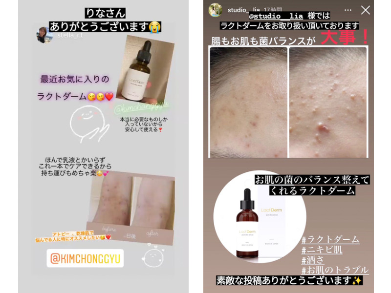 ラクトダーム美容液を使った肌の変化