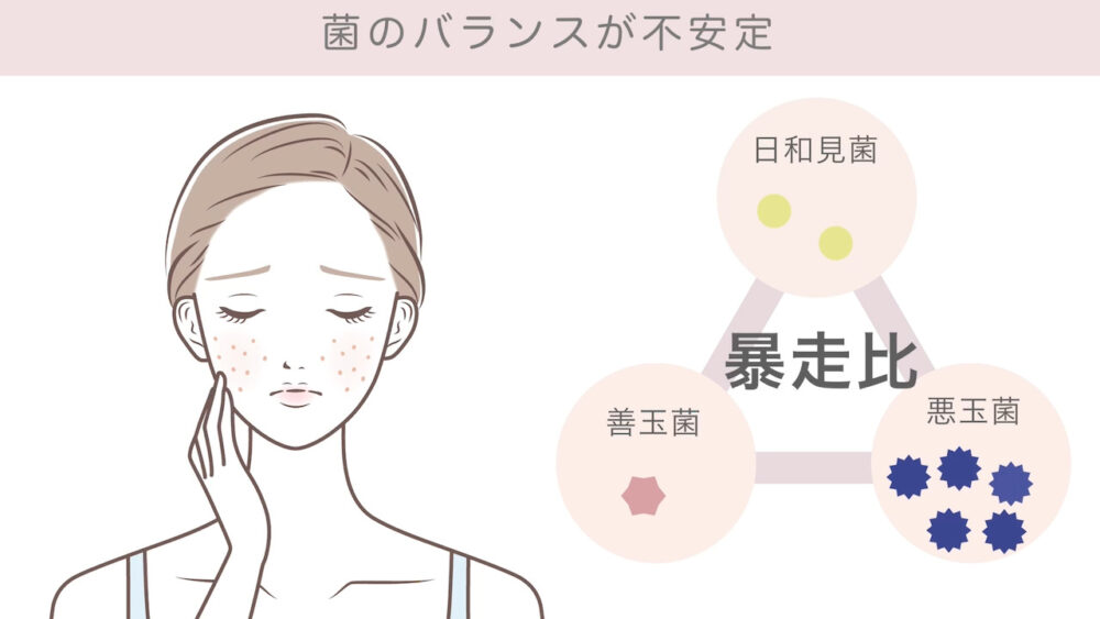 お肌の常在菌のバランスが悪いとき